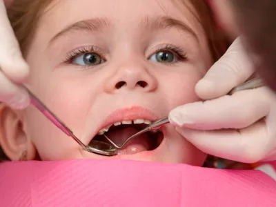 טיפול שיניים לילדים עם אוטיזם